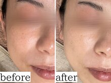 アンドナップ(nap)の雰囲気（あらゆる肌質・症状にきめ細かく応え理想の肌へ♪）