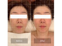 サロン ニニニ(salon 222)の雰囲気（チノザメソッド技術を用いた小顔矯正でシンメトリーな骨格へ☆）