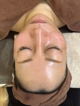 エステテックサロンラレーヌ 小山店(La Reine)/韓国ツヤ肌フェイシャル