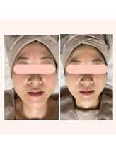 モンクール(mon coeur)/ララピール×フォト