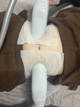 ゴールデンエイジ(Golden Age)/くびれを作るならこれ！！