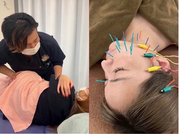 松戸駅前鍼灸院 整骨院の写真/身体や骨盤の歪みを整え悩み改善！平日限定骨盤矯正1500円～★むくみ/ニキビ/たるみ/しわ改善 美容鍼2980円