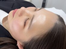 エステティック リベル キョウト 京都駅前店(Esthetic Liber Kyoto)の雰囲気（エステ版ポテンツァ水光肌注入）