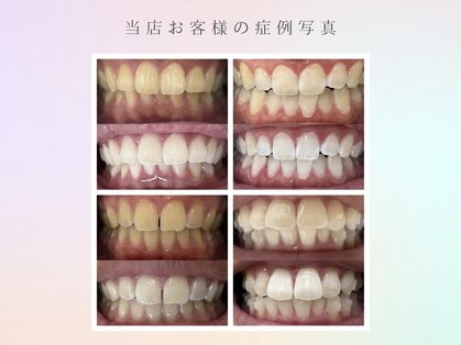 サロン ベレッツァ(Salon Bellezza)の写真