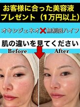 スペチアーレ 夙川/2万円相当美容液プレゼント