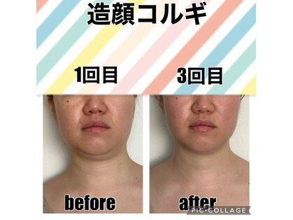 ルース(LUCE)の写真
