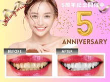 エクシアホワイトフジ(ecxia white fuji)