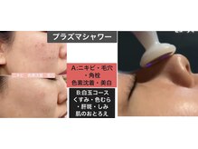 メディケアスキンラボ 新宿の雰囲気（プラズマシャワー9900毛穴角栓黒ずみくすみプラスマリフトも有）