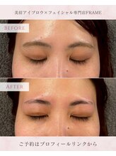 フレーム(FRAME)/眉周りの産毛対策にも◎