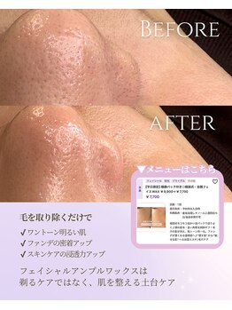 ウノ アッベリーナ(UNO × abbel'lina)/フェイシャルアンプルワックス