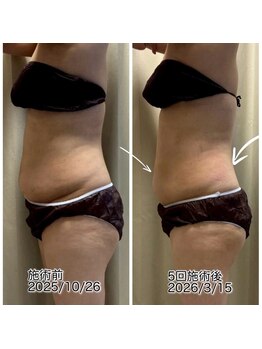 クールスパ(COOL SPA)/【100カップチャレンジ経過】