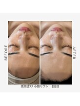 ワイビューティ(Y.Beauty)/