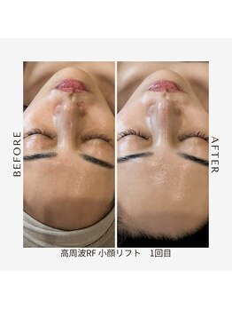 ワイビューティ(Y.Beauty)/