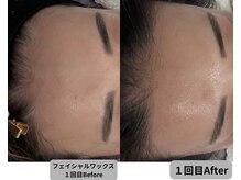 ミシル(Mishil)/パールワックス初回