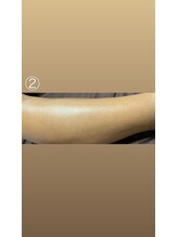 エステサロン桜/半ズボンも似合う美脚に♪