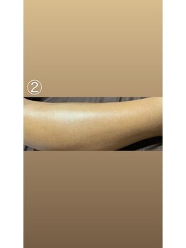 エステサロン桜/半ズボンも似合う美脚に♪