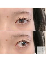 アマリリス(Amaryllis)/