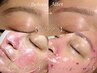 眉WAX＋FACE WAX＋HIDRO JELLY MASK 【大人気】