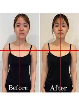 ドクターボディ 浜松店(Dr.Body)/【歪み/左右差/肩こり/姿勢】