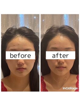 ビューティーサロン リリー(Lily)/