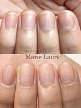 マリーロール 淀屋橋本店(Marie Laure)/自爪育成/深爪矯正/ネイルケア