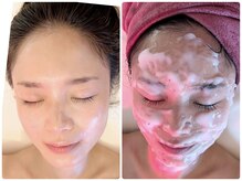 ティアラ(TIARA)/炭酸ガスパック