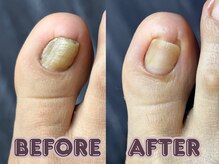 ポドロ ウィズ ニコルル 大阪天満店(PoDoLo with Nicolulu)/【分厚い爪】フットケア大阪梅田