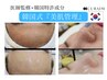 【男女OK！韓国医療提携CURAIM導入】プラズマ×韓国特許成分で美肌管理♪特価