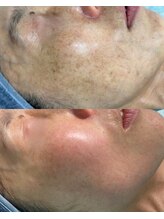 リメイククリニカルビューティー(Remake clinical beauty) 根本改善 結果重視