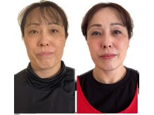 ヨサパーク メリー(YOSA PARK merry)/見た目が変わった♪