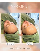 リノ(LINO)/フェイシャルケア“セルマン”