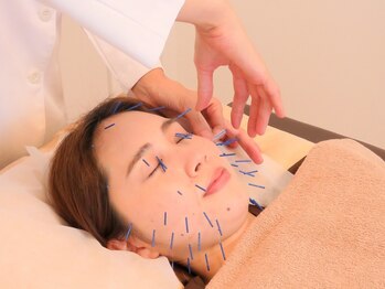 ハリンカ 札幌(HARINKA)/