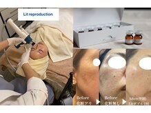 ラボーテエサンテ バイ ティアラ(la beaute et sante by Tiara)の雰囲気（幹細胞×最新マシンで速攻エイジングケア）