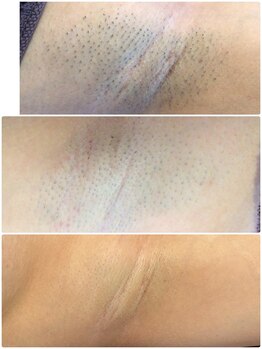 アネル うるま店(anel)/