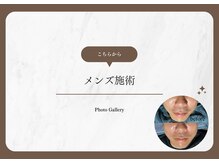 アマランサス(Amaranthus)/メンズ施術例