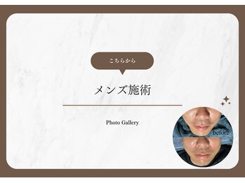 アマランサス(Amaranthus)/メンズ施術例