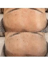 ヴェルシック(Belchic)/すっぴんでも怖くない美しい素肌