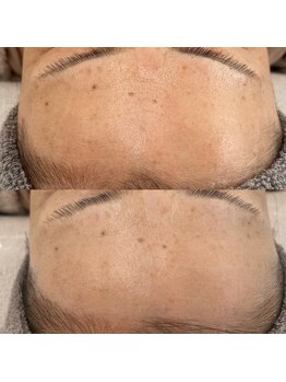 ヴェルシック(Belchic)/すっぴんでも怖くない美しい素肌