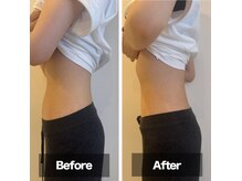 フォトギャラリーに嬉しい声沢山!!  堀江 小顔矯正 美容鍼