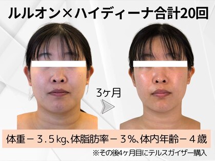 ヨサパーク オハナ(YOSA PARK ohana)の写真