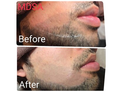 エムディーエスエー(MDSA)の写真