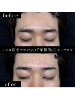 ユー 千葉駅前店(you)/ビフォ－アフター写真