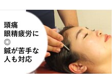 高橋整骨院鍼灸院の雰囲気（～終わりのある美容鍼～眼精疲労に◎のてい鍼やセルフケア付！）