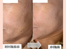 ルアナ(Luana)の雰囲気(【最新光フォト】シミ改善だけでなく肌全体が変化します◎)