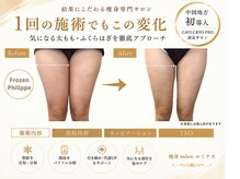 ルミナスの雰囲気（脂肪冷却、キャビテーションで二の腕、お腹、太ももに本気エステ）