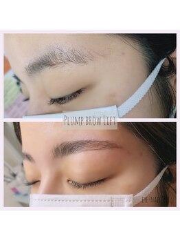 ジル(JILL)/Plump Brow Lift