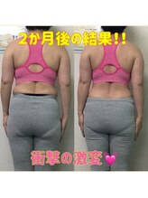 シンメトリー 上野店/お客様施術【上野/御徒町/小顔】