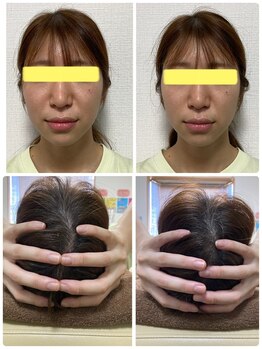 千種くま整体院/☆小顔矯正☆