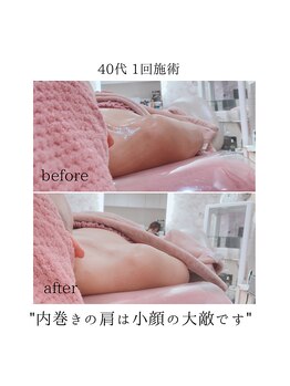 エミ(emi)/首肩周りを弛めると小顔効果持続