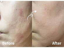 サロンドミジュ(Salon de 美jyu)/プラチナ肌質改善